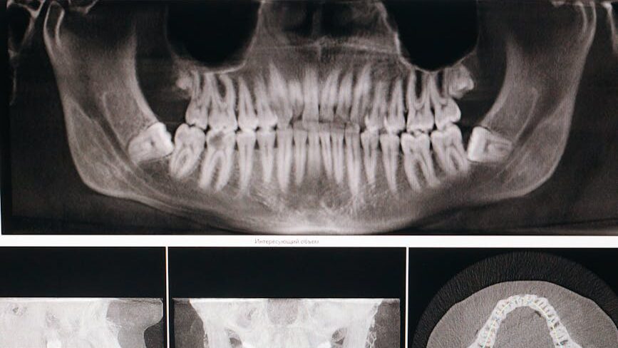 an x ray image of a jawbone in the computer